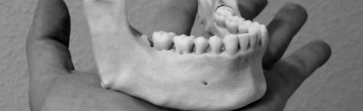 Ejemplo de mandibula impresa en 3D