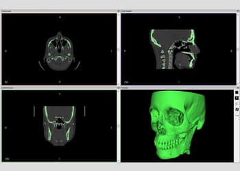 Ejemplo del segmentado en un proyecto