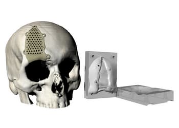 Ejemplo de un Smartmold